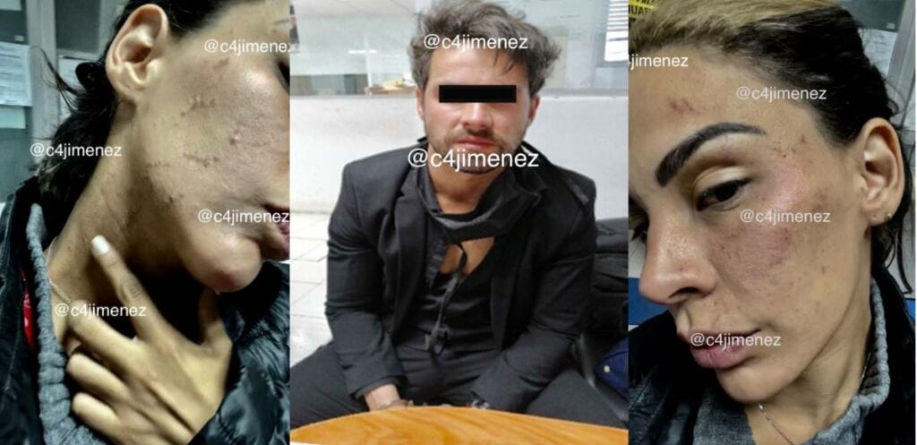 El actor Eleazar Gómez agredió a su novia porque rechazó su propuesta de matrimonio y fue arrestado (video)