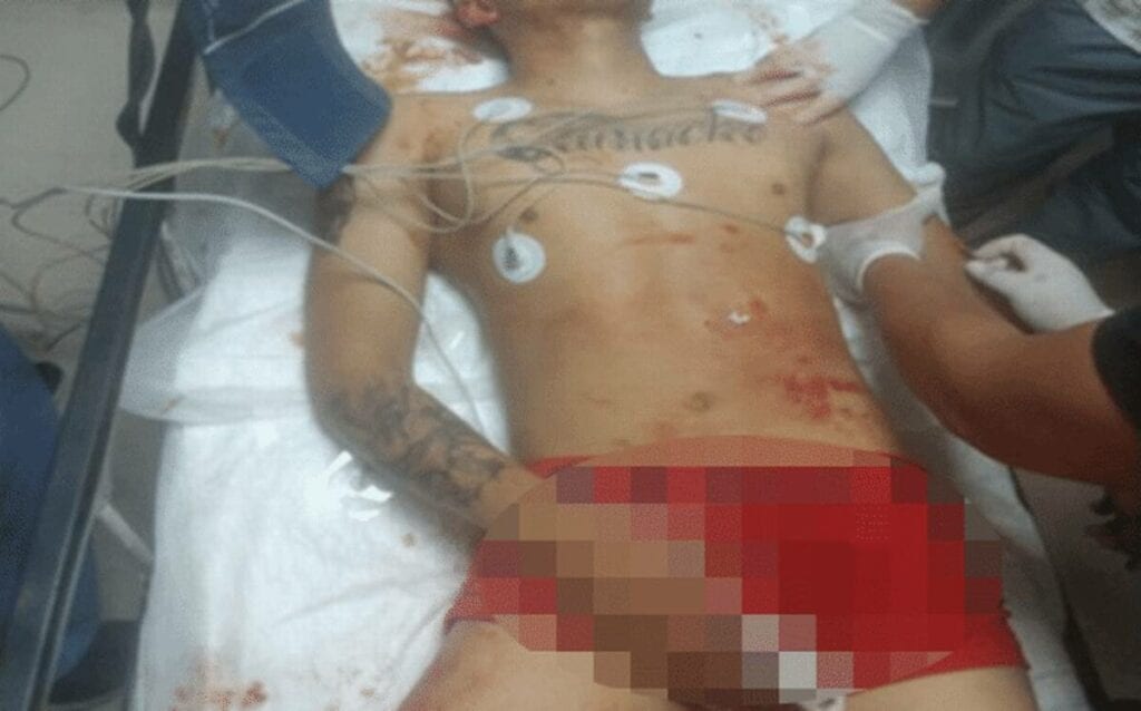 Un hombre recibió balazos en la cabeza, la espalda y una pierna