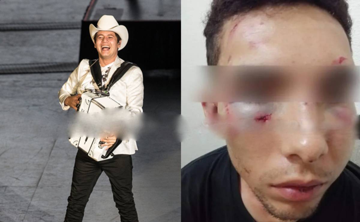 El cantante Remmy Valenzuela le fractura el pómulo a su primo, quien recibió una paliza junto a su novia