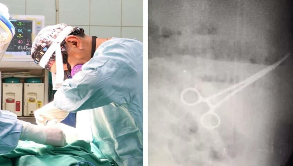 Un hombre en Venezuela murió luego de someterse a una cirugía, durante la cual los médicos olvidaron unas tijeras dentro de su estómago.